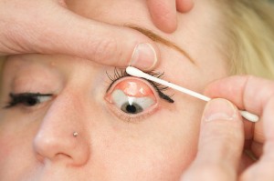 contact lens aftercare